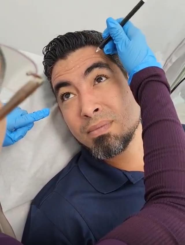Botox image 1